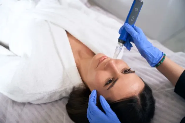 microneedling treatment in arlington, va