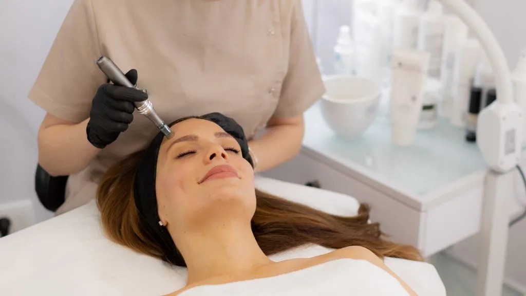 microneedling treatment