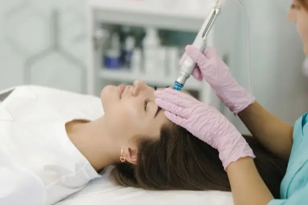 Microdermabrasion Services