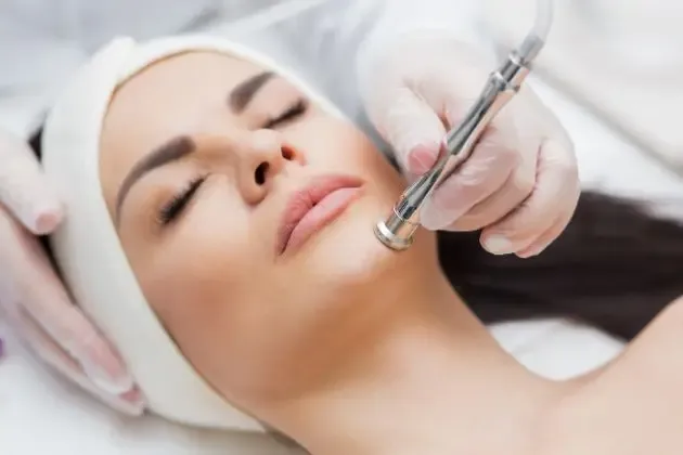 microdermabrasion treatment in mclean, va