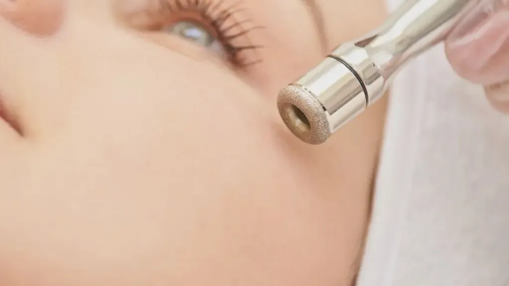 benefits of microdermabrasion