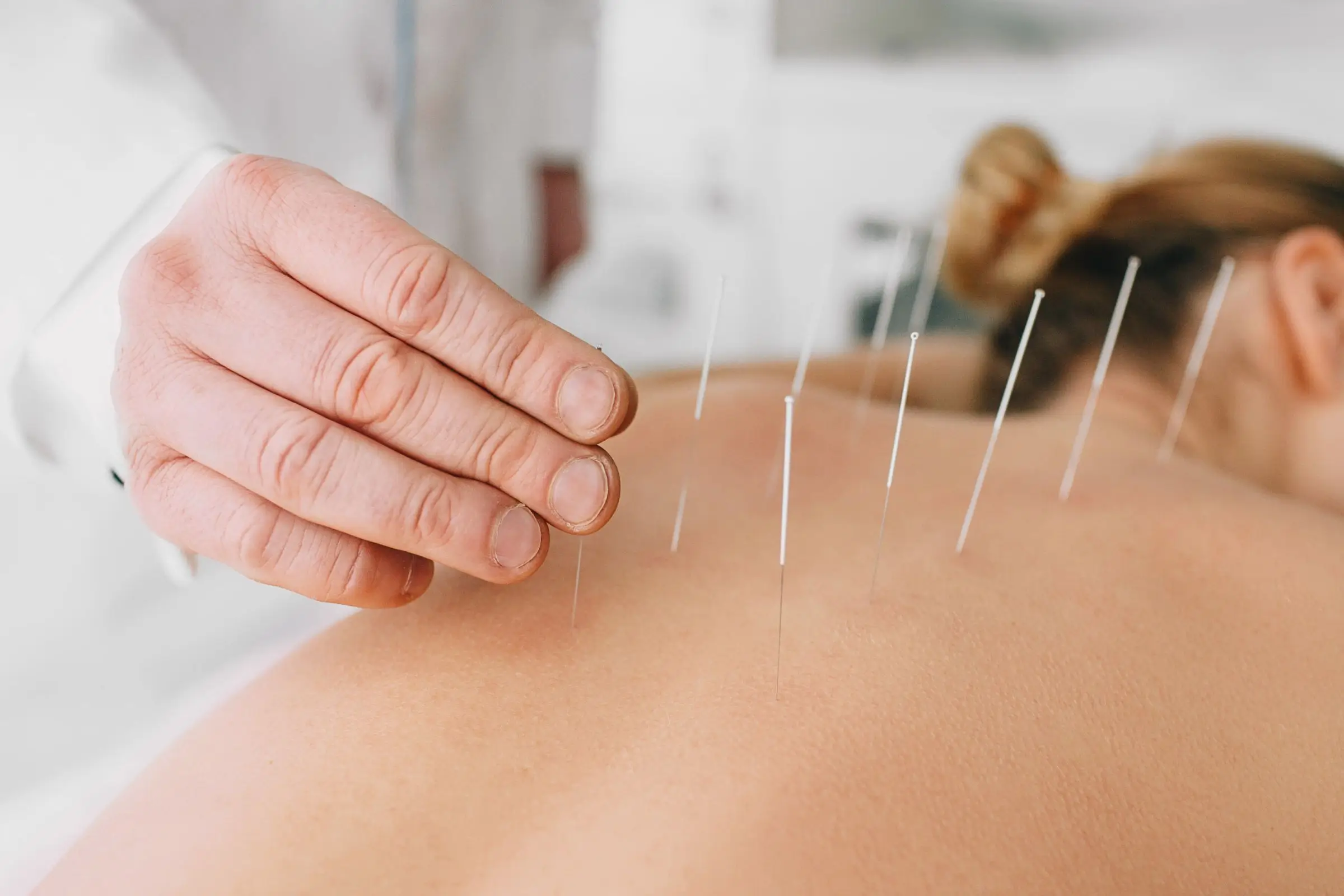 acupuncture Spa in Fairfax, VA