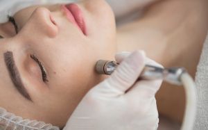Microdermabrasion Facial