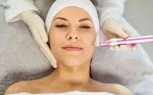 Microneedling