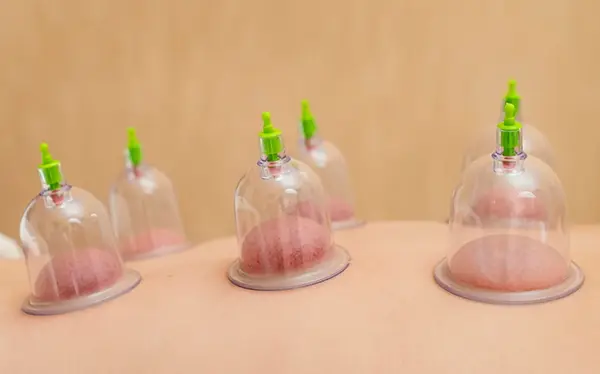 The 90-Minute Autumn Escape Cupping