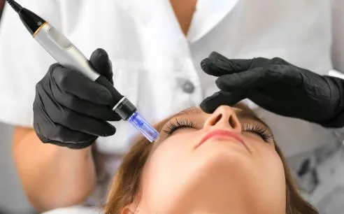 microneedling in mclean va
