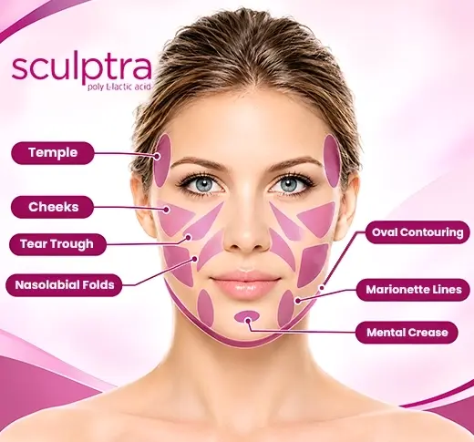 sculptra benefits
